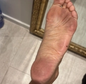 더티풋 노출